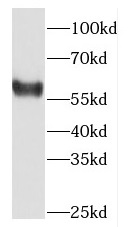 DACH2 antibody|DACH2抗体