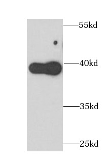 APOL1 antibody|APOL1抗体 FNab005