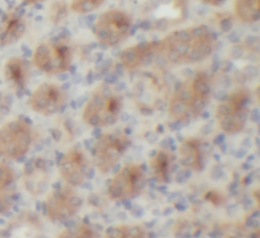 RECK antibody|RECK抗体 FNab10074