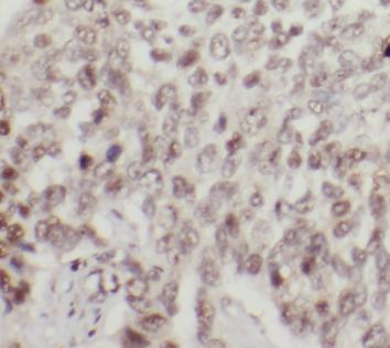 CREB1 antibody|CREB1抗体 FNab099