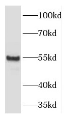 DNPEP antibody|DNPEP抗体