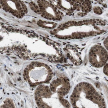 RNF40 antibody|RNF40抗体