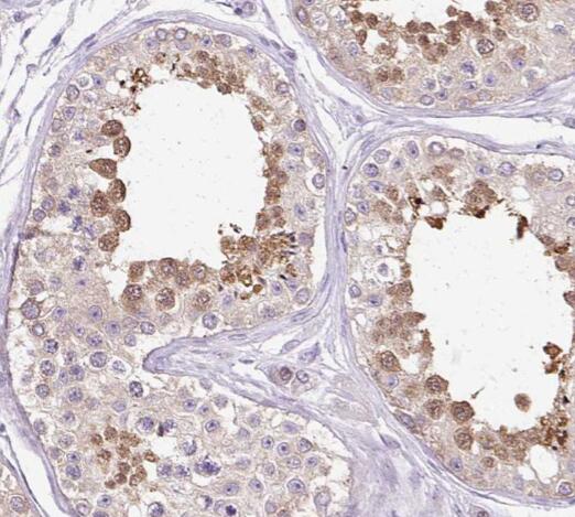 SALL4 antibody|SALL4抗体 FNab075