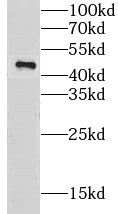 CKMT1A antibody|CKMT1A抗体