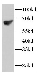 ETFDH antibody|ETFDH抗体