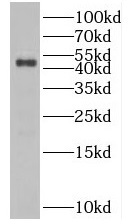 BFSP2 antibody|BFSP2抗体