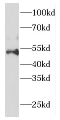 DCTN2 antibody|DCTN2抗体 FNab025