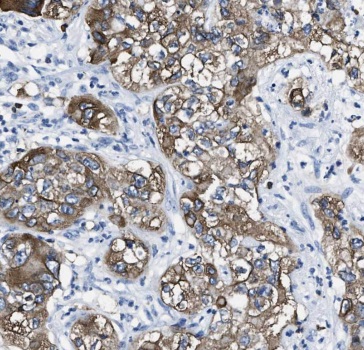 MDK antibody|MDK抗体