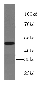 SYT4 antibody|SYT4抗体 FNab08431