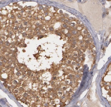 HDAC6 antibody|HDAC6抗体 FNab038