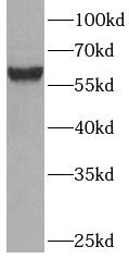 SLC2A2 antibody|SLC2A2抗体 FNab0