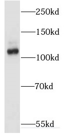 EPB41L1 antibody|EPB41L1抗体