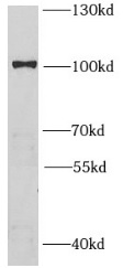 HMGCR antibody|HMGCR抗体 FNab039