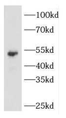 KRT14 antibody|KRT14抗体 FNab021