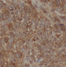 XDH antibody|XDH抗体 FNab10052