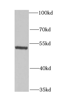 GLUD1 antibody|GLUD1抗体