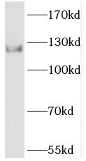 PHKB antibody|PHKB抗体