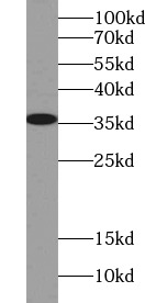 CLEC11A antibody|CLEC11A抗体 FNa