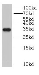 CCND3 antibody|CCND3抗体
