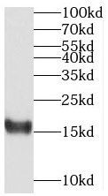 MED31 antibody|MED31抗体