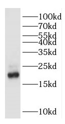 GKN2 antibody|GKN2抗体