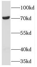 TBRG4 antibody|TBRG4抗体 FNab085