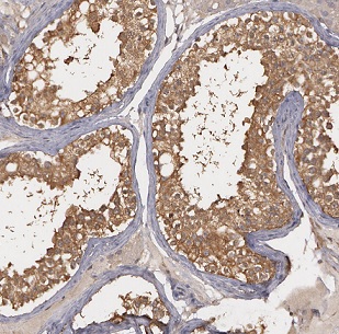 BBS7 antibody|BBS7抗体