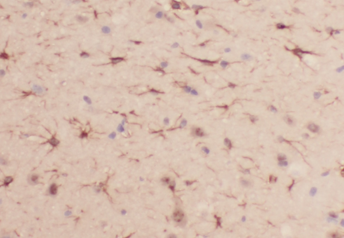 PRDX6 antibody|PRDX6抗体