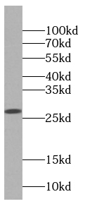 DGUOK antibody|DGUOK抗体 FNab023