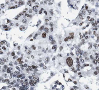 Histone H1.2 antibody|Histone 