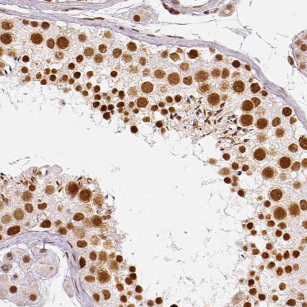 LSG1 antibody|LSG1抗体