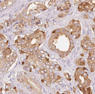 LRRC1 antibody|LRRC1抗体