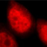 DHX9 antibody|DHX9抗体