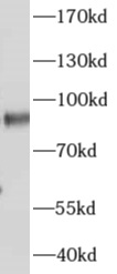 AKAP4 antibody|AKAP4抗体
