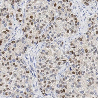 MPHOSPH6 antibody|MPHOSPH6抗体