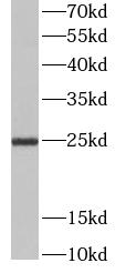 CD9 antibody|CD9抗体 FNab01508