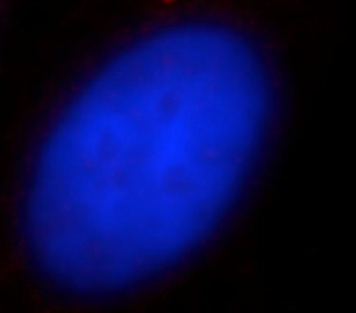 CENPJ antibody|CENPJ抗体