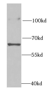 RPN2 antibody|RPN2抗体
