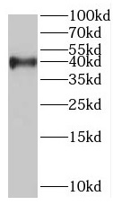 RABEPK antibody|RABEPK抗体 FNab0