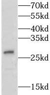 LY6K antibody|LY6K抗体