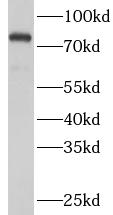 HSPA5 antibody|HSPA5抗体 FNab099