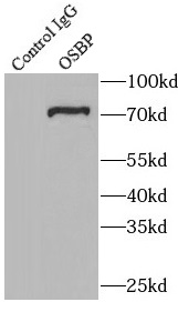 NF2 antibody|NF2抗体 FNab05685