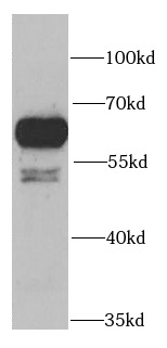 PRPF19 antibody|PRPF19抗体