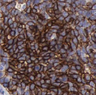 KRT14 antibody|KRT14抗体 FNab021