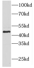 FOXO4 antibody|FOXO4抗体 FNab032