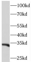 PITPNB antibody|PITPNB抗体