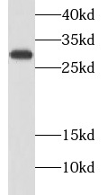 CALB2 antibody|CALB2抗体 FNab012