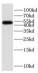 ESRRB antibody|ESRRB抗体