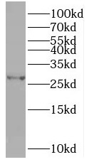 TPK1 antibody|TPK1抗体