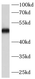 PNPLA3 antibody|PNPLA3抗体